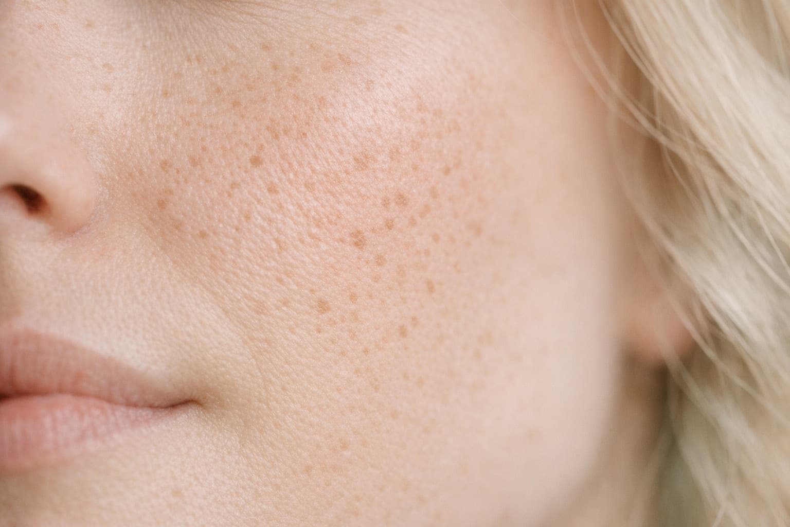 A close view of a cheek in daylight, showing pores and light freckling